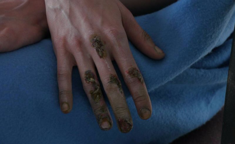 out of kit sfx make up scrapes